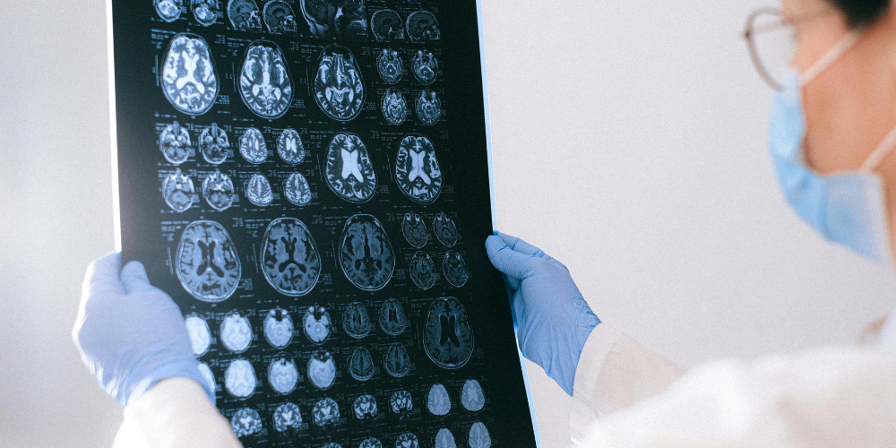 MRI Report Transcription Process Explained Clearly